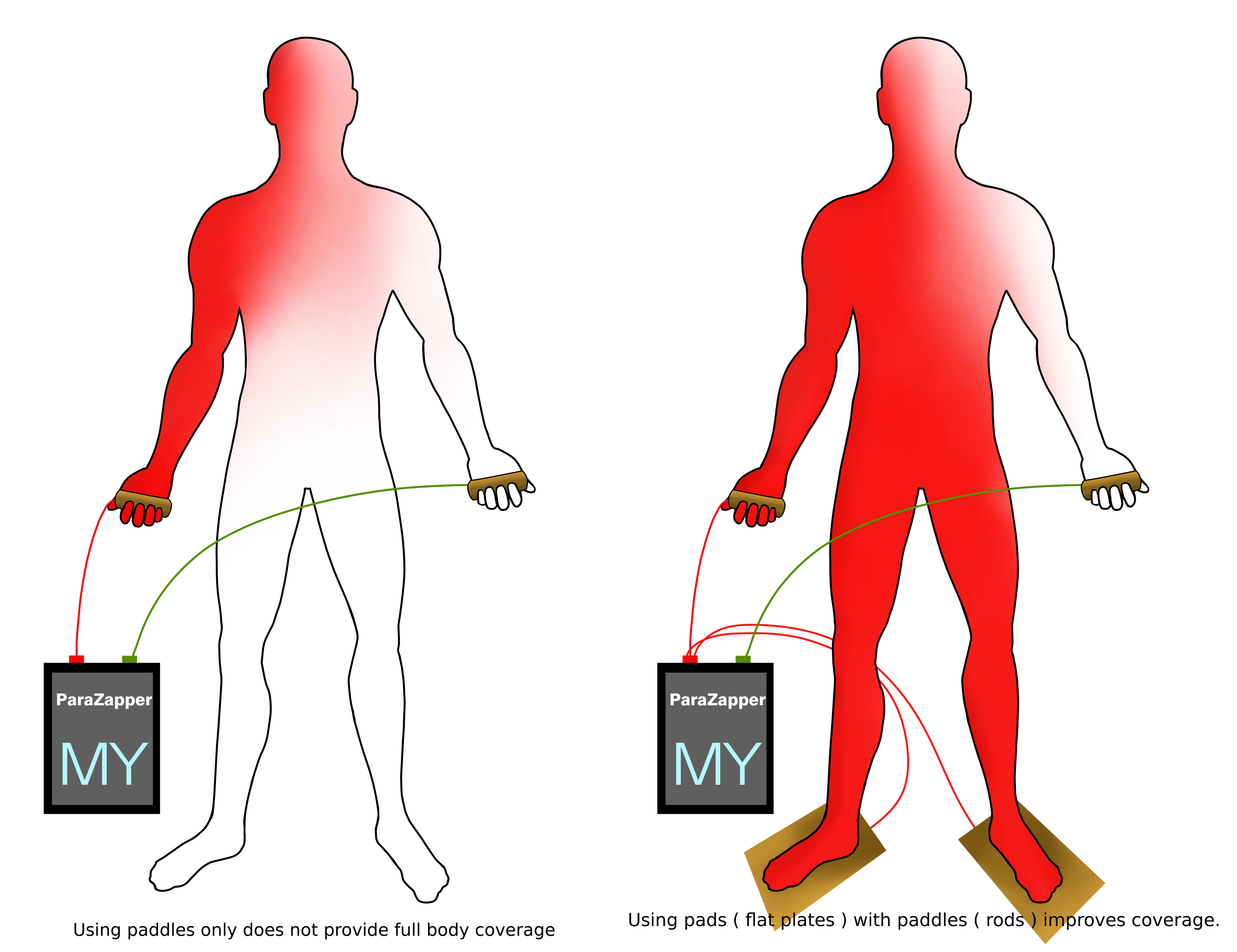 ParaZapper™ Dr. hulda clark zapper, parasite zapper, hulda's zapper, parasites, dr hulda clark parasite zapper, parasite